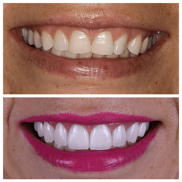 Cali Dental Arts Before and After Photo