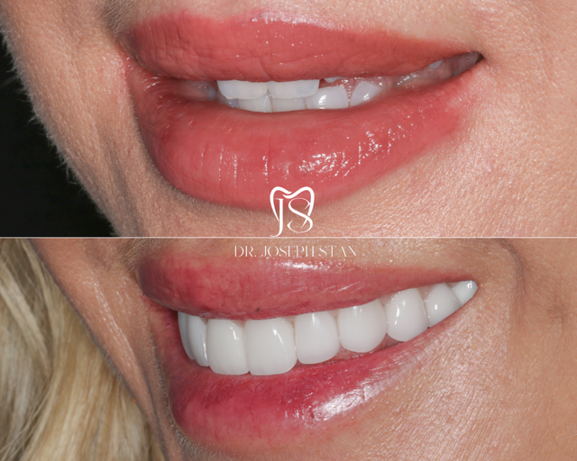 Cali Dental Arts Before and After Photo